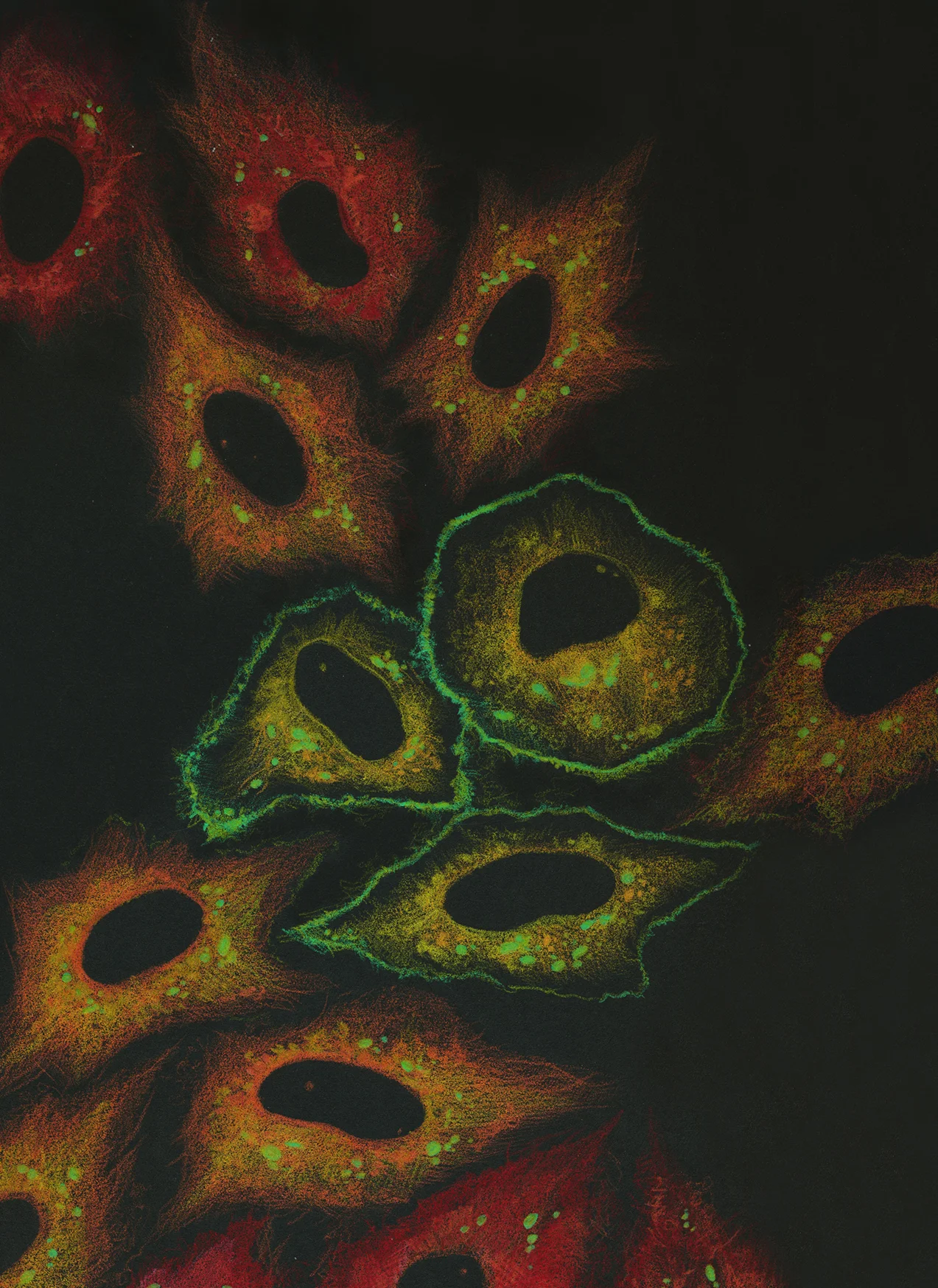 AT_Cell_Reports_Small.jpg