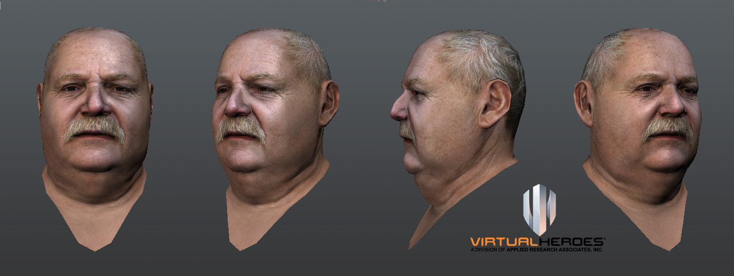 obese_patient_head.jpg