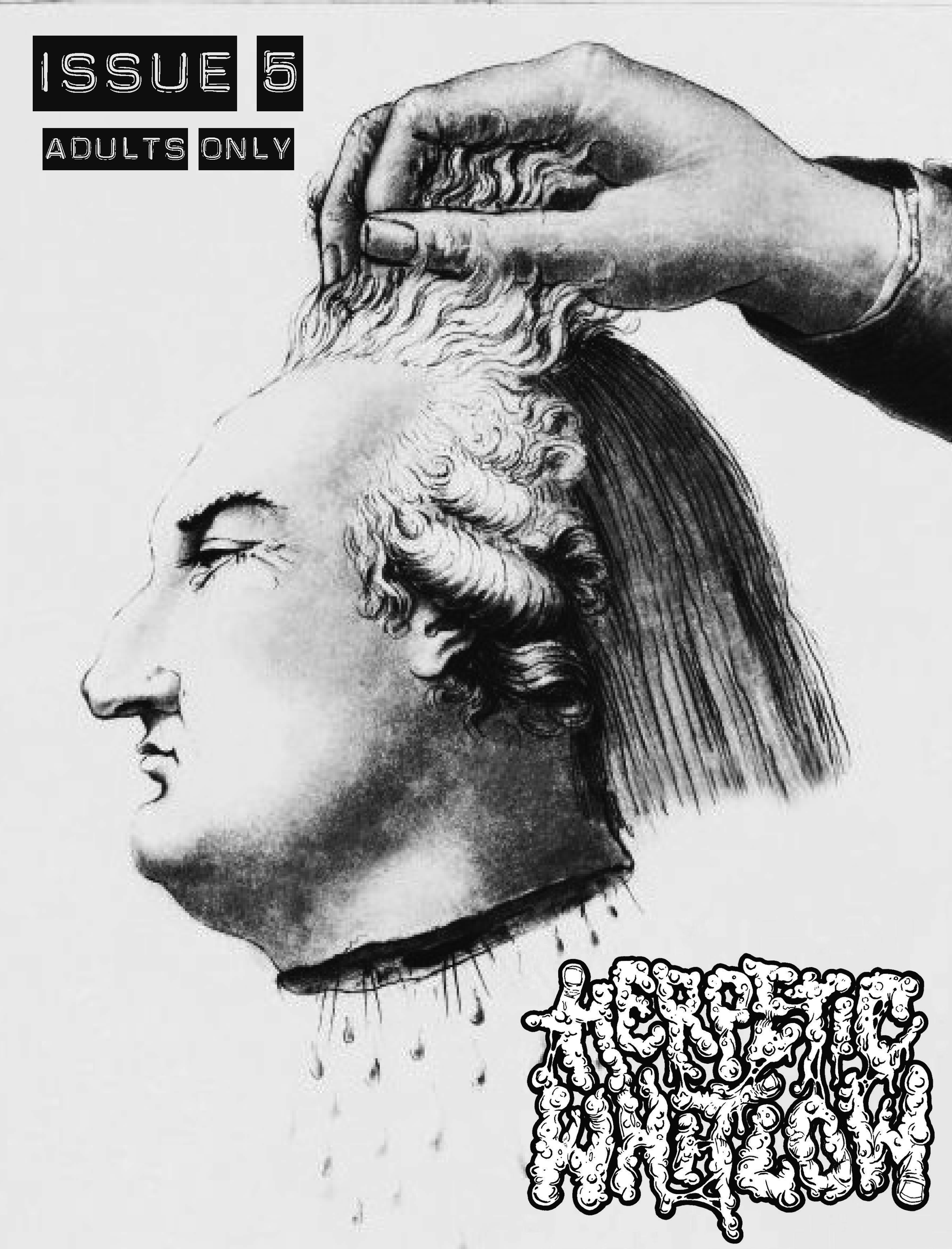 Herpetic Whitlow 5 B&W_Page_01.png