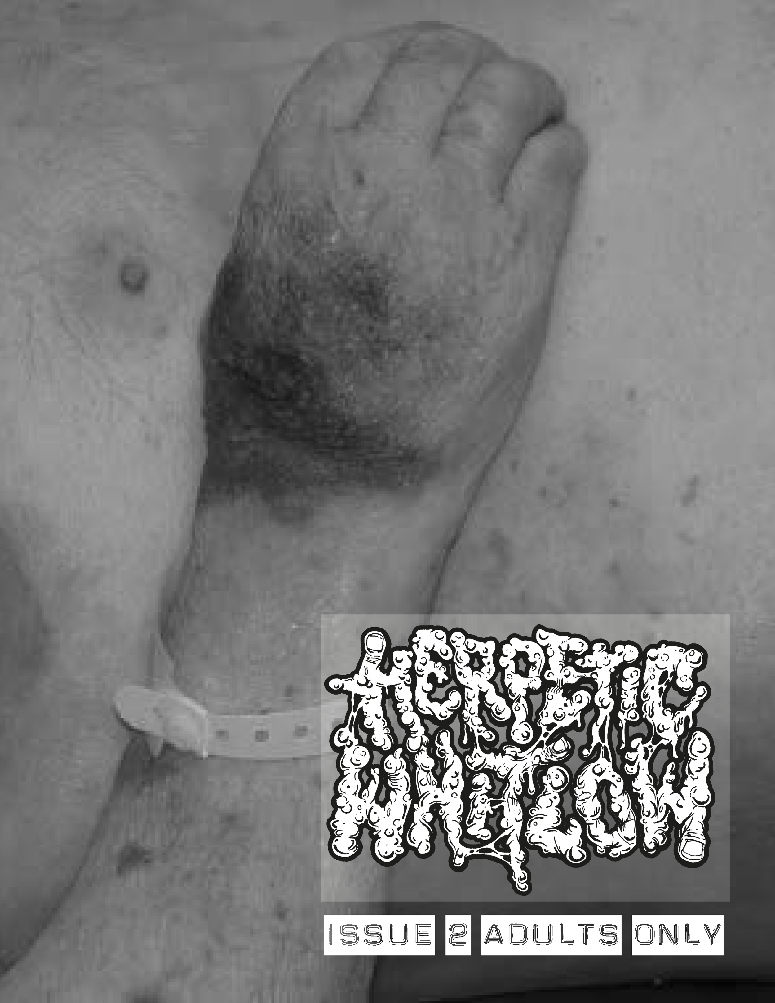 Herpetic Whitlow 2.0GS_Page_01.png