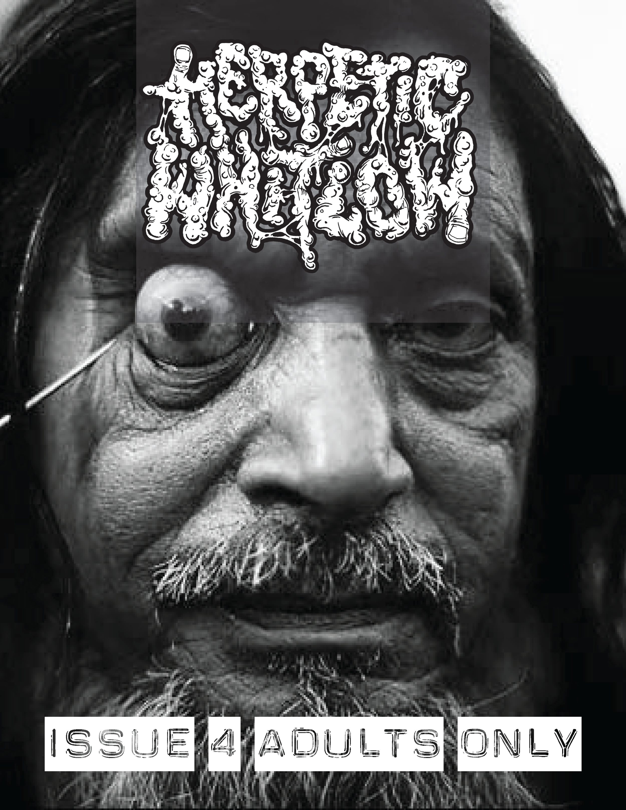 Herpetic Whitlow 4 B&W_Page_01.png