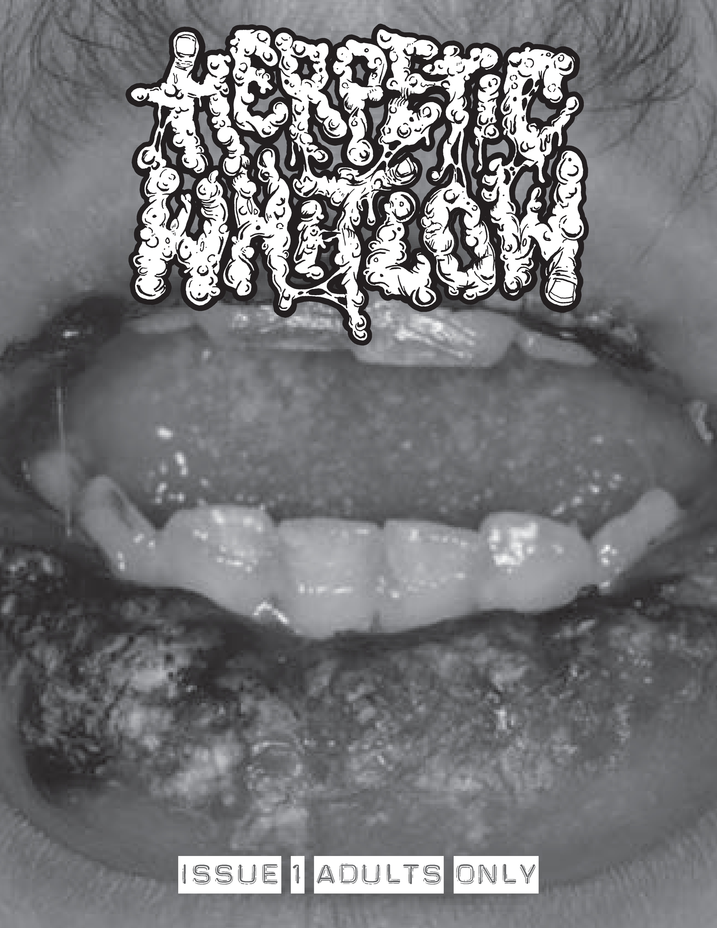 Herpetic Whitlow 1 grayscale_Page_01.png