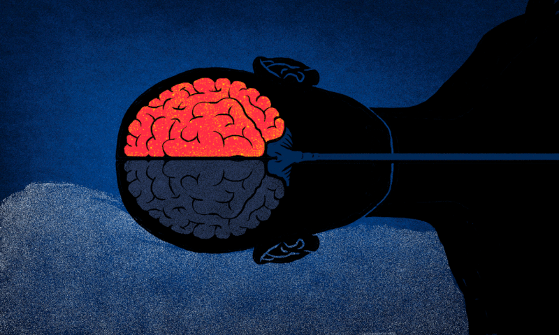 brain cleaning .gif