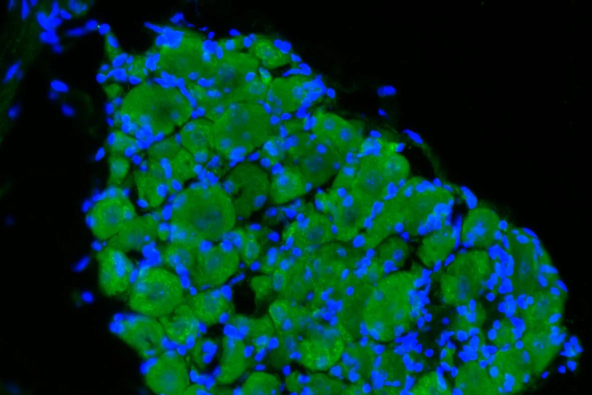 DRG Slice_Mu Opioid Receptor with DAPI_2.jpg