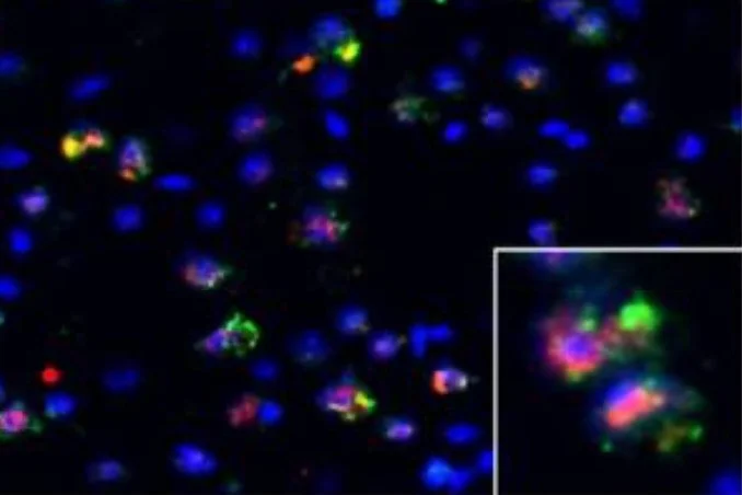  Congratulations to Aaron, Christine, and Grace for their first-author papers this past year!  Held A, Adler M, Marques C, Reyes CJ, Kavuturu AS, Quadros ARAA, Ndayambaje IS, Lara E, Ward M, Lagier-Tourenne C, Wainger BJ.   iPSC motor neurons, but no