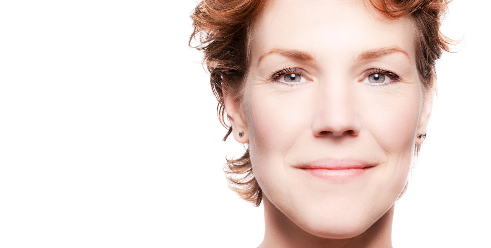  What the heck is a chemical peel?