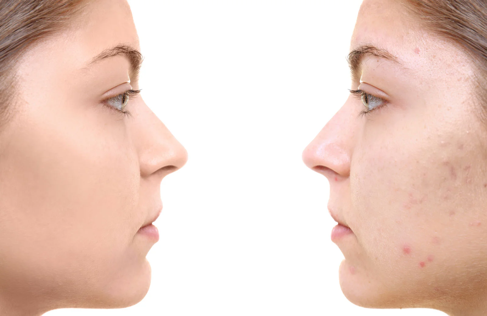led light facial near me