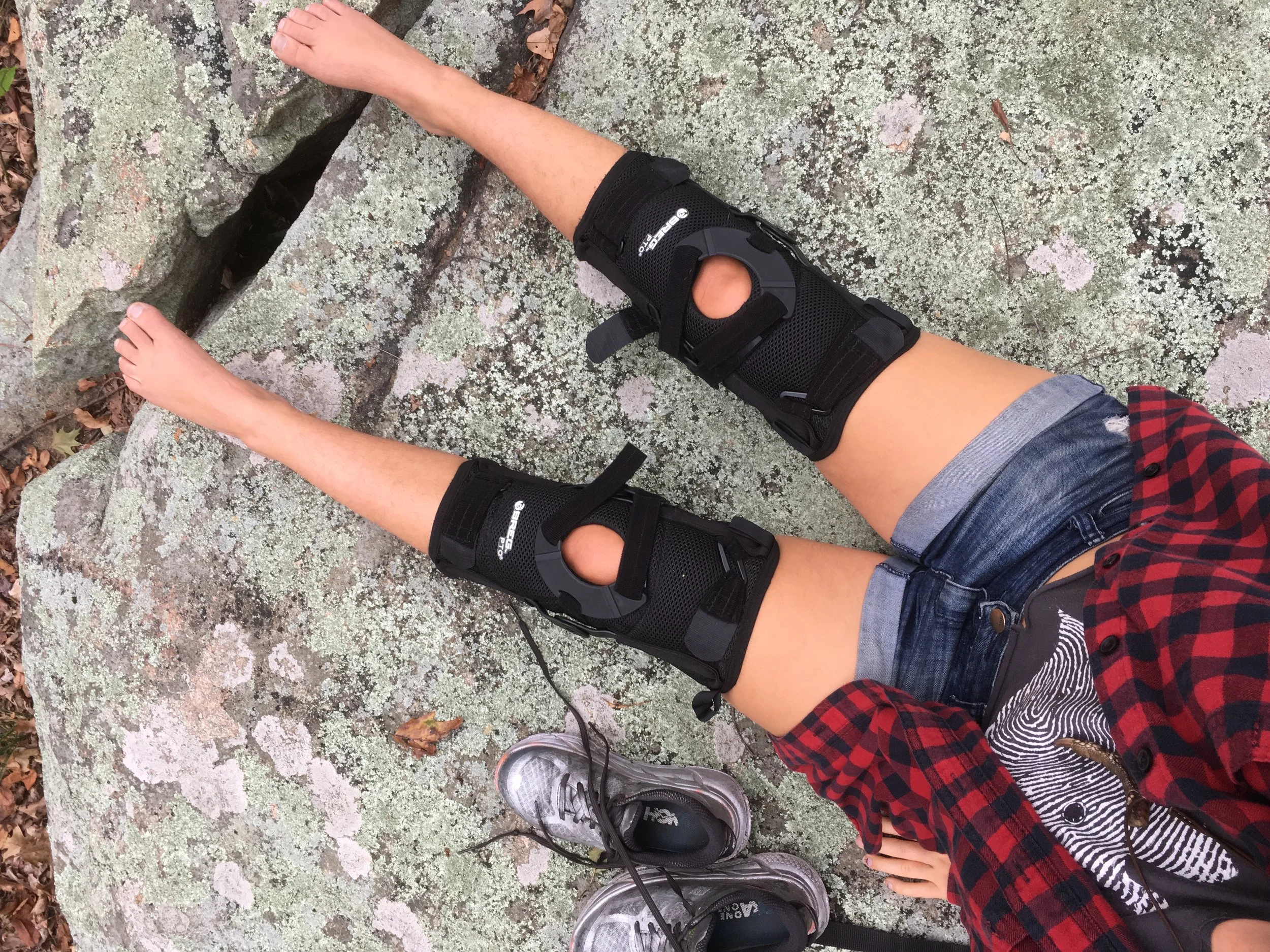 Photo Description: a shot of Eliana's legs as she lounges on a rock in a plaid shirt and shorts, her knee braces clearly visible.