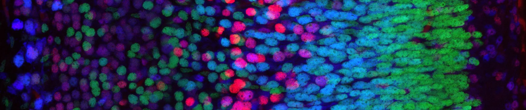 P0 cortex inset2.jpg