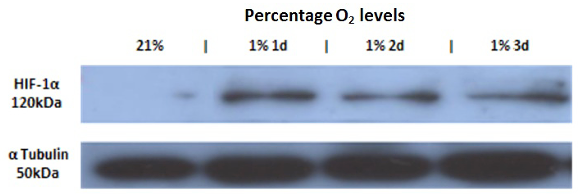 Figure 4 . Western blotting analysis showing stabilisation and ac- cumulation of HIF-1 protein in HeLa cells incubated in hypoxic conditions (1% O 2 ) for 1, 2 and 3 days. -Tubulin was used as a loading control in normoxic conditions (21% O 2 ); n=1. 