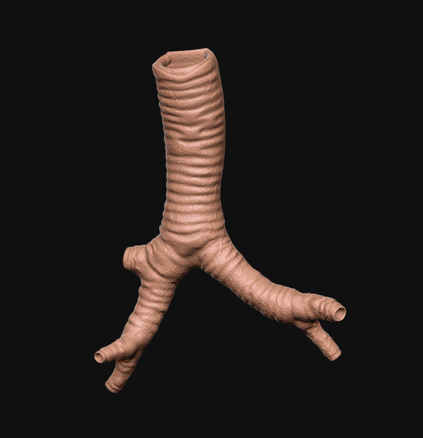 3D rendering animation of Trachea for 3D Print. 3D Systems in San Diego. LA Digital Sculptor and Artist. 3D printed to human body.