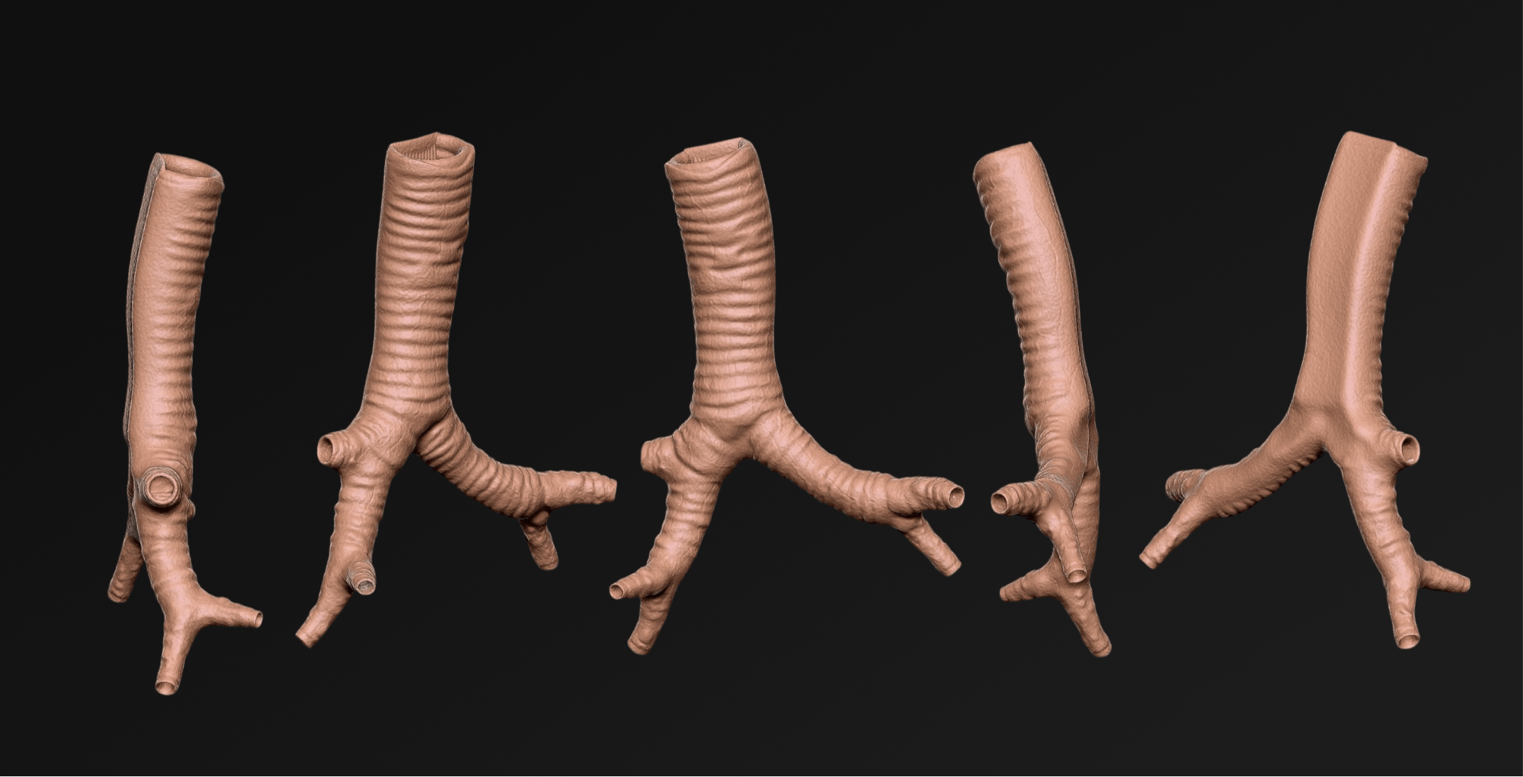 360 angles of a 3D rendering of Trachea for 3D Print. 3D Systems in San Diego. LA Digital Sculptor and Artist.
