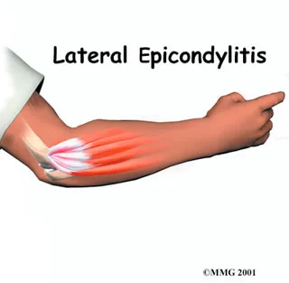 Blog Articles Arrow Physical Therapy Seattle