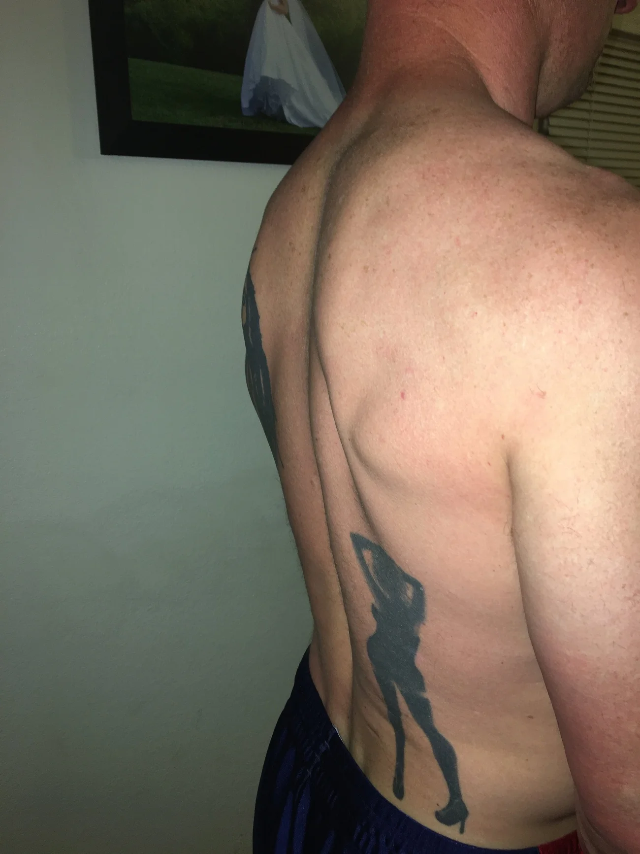 Many time the flat thoracic spine is hard to see. This athlete has a flat thoracic spine but his muscular development (of the muscles which EXTEND the spine, no less) is fooling your eye.