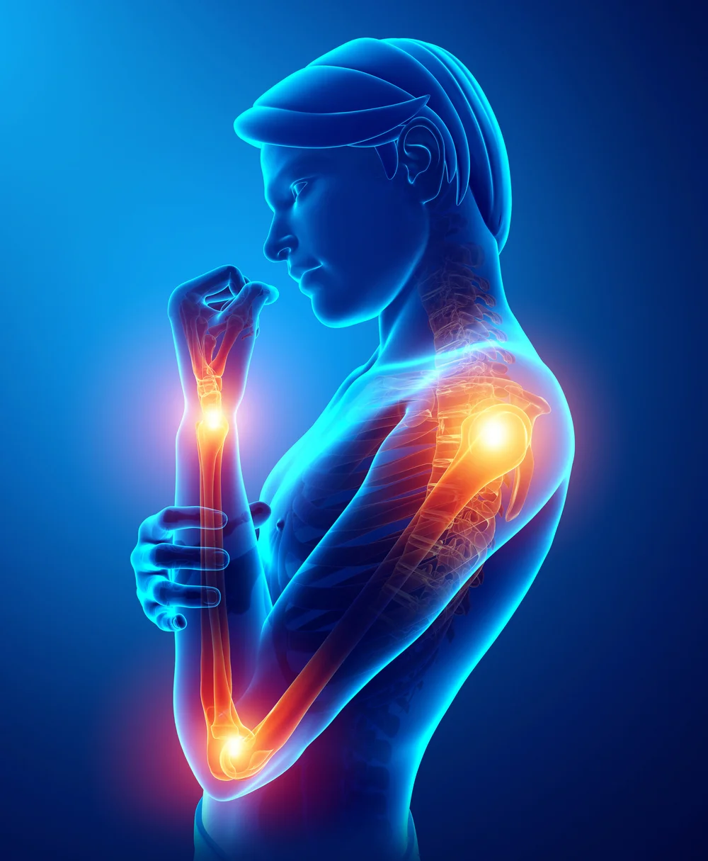 Do You Have Pain In The Front Rack Position? — Arrow Physical Therapy  Seattle