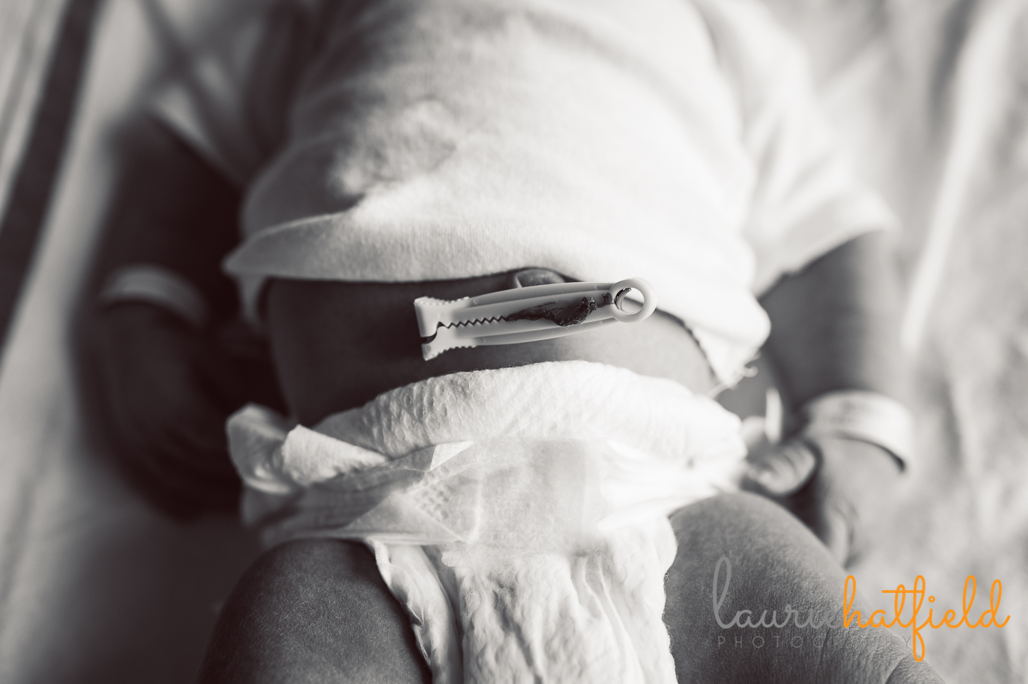 baby with umbilical cord clamp | Huntsville newborn photographer