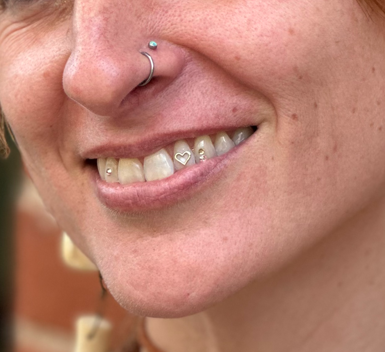 Are Tooth Gems Safe? What Austin Clients Should Know