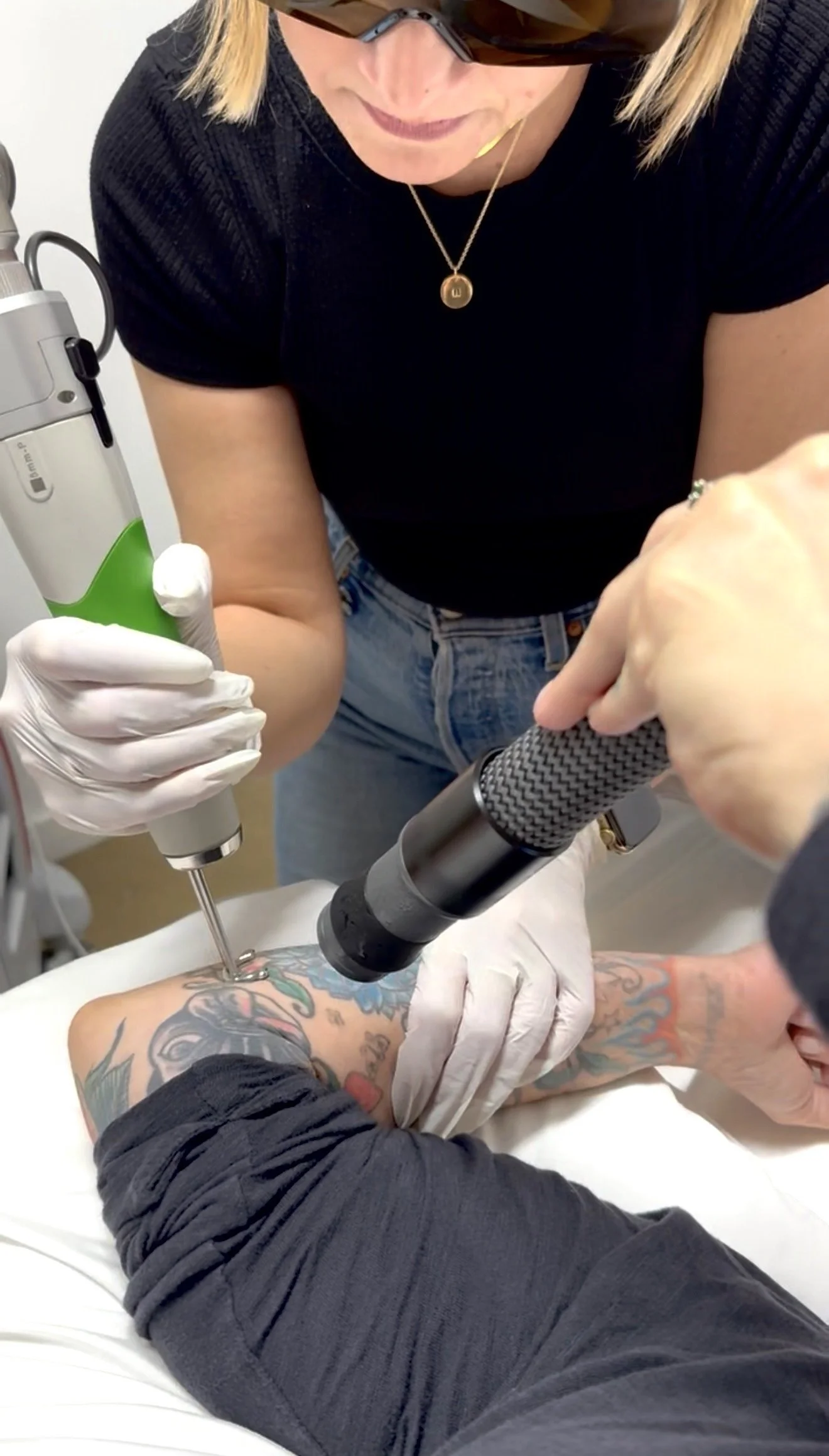 Can You Speed Up Tattoo Removal? Austin Laser Tech Answers