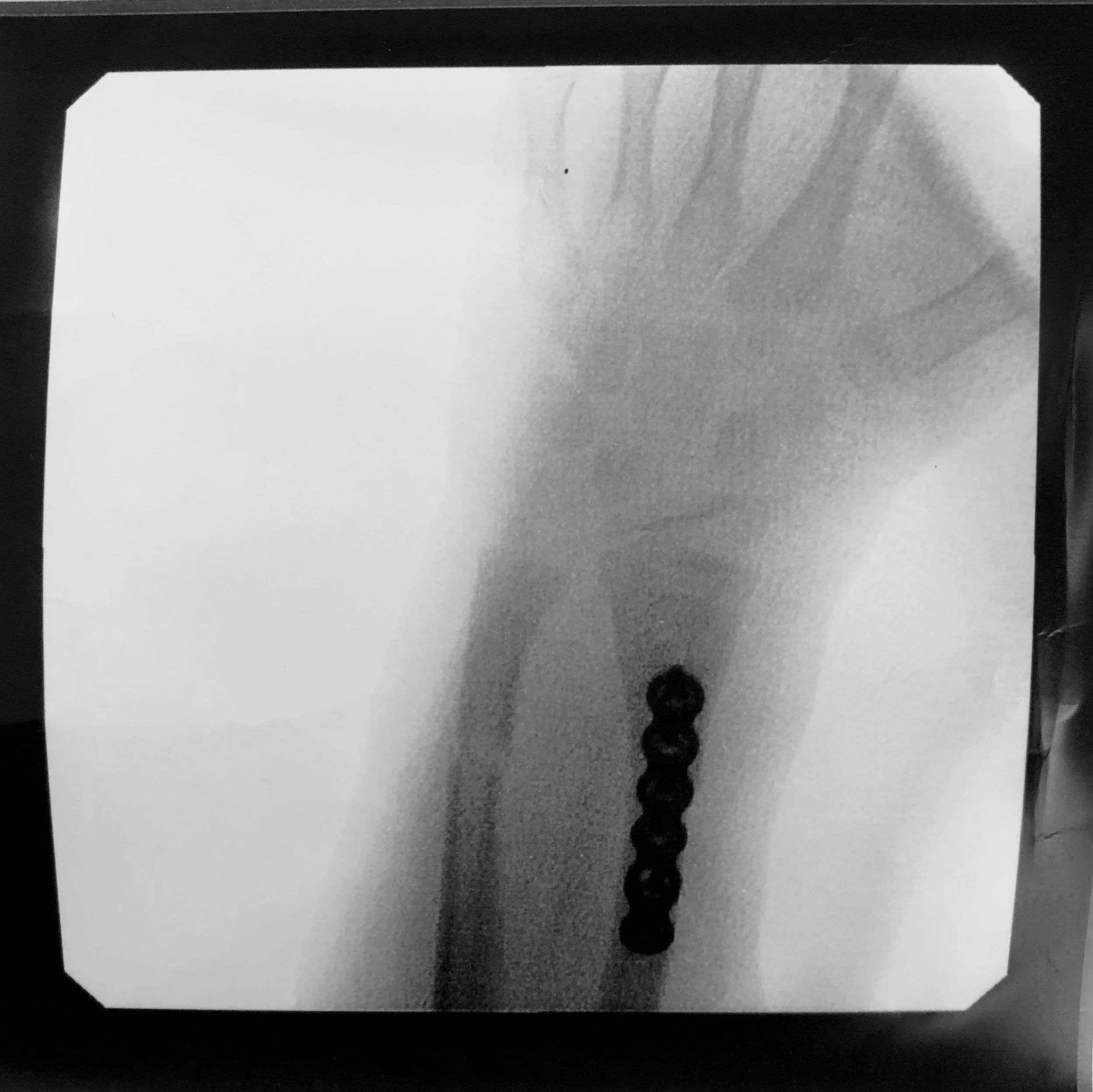 Non-Required Reading: A New Years Reflection of Sorts