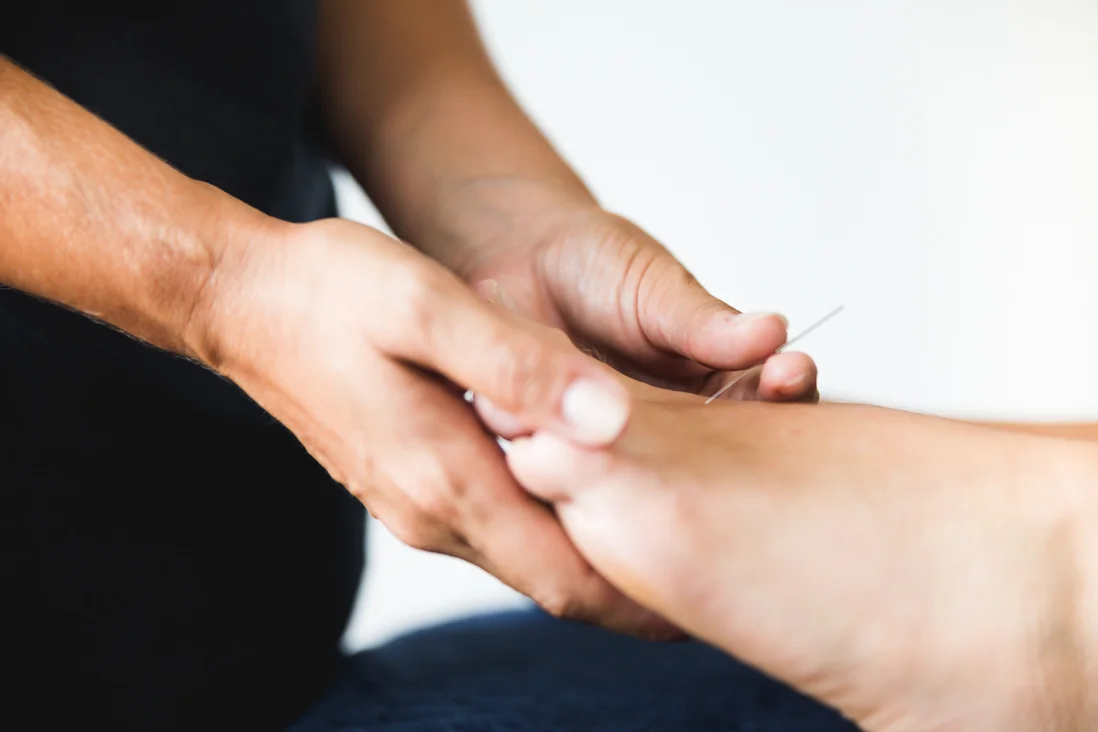 Considering Acupuncture and IVF?