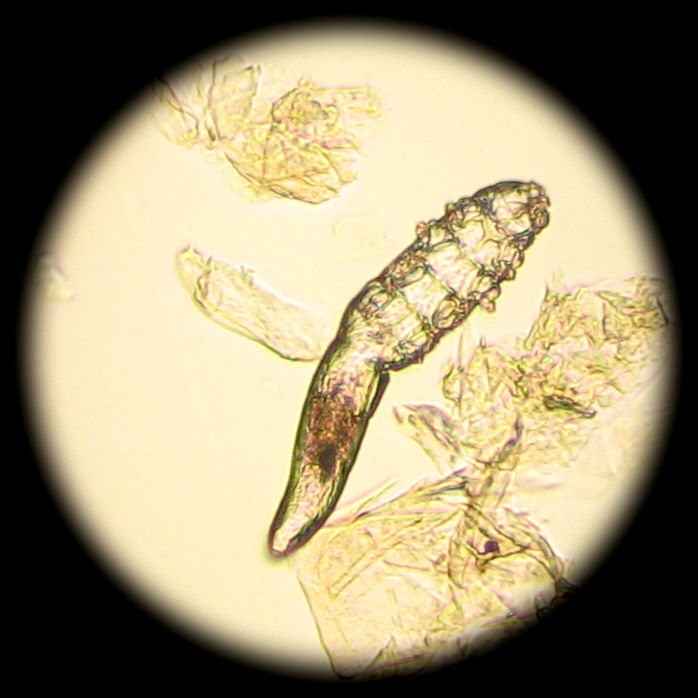 Demodex mites are microscopic, you will not be able to see them with the naked eye. From: http://www.petmd.com/sites/default/files/demodex_019.jpg