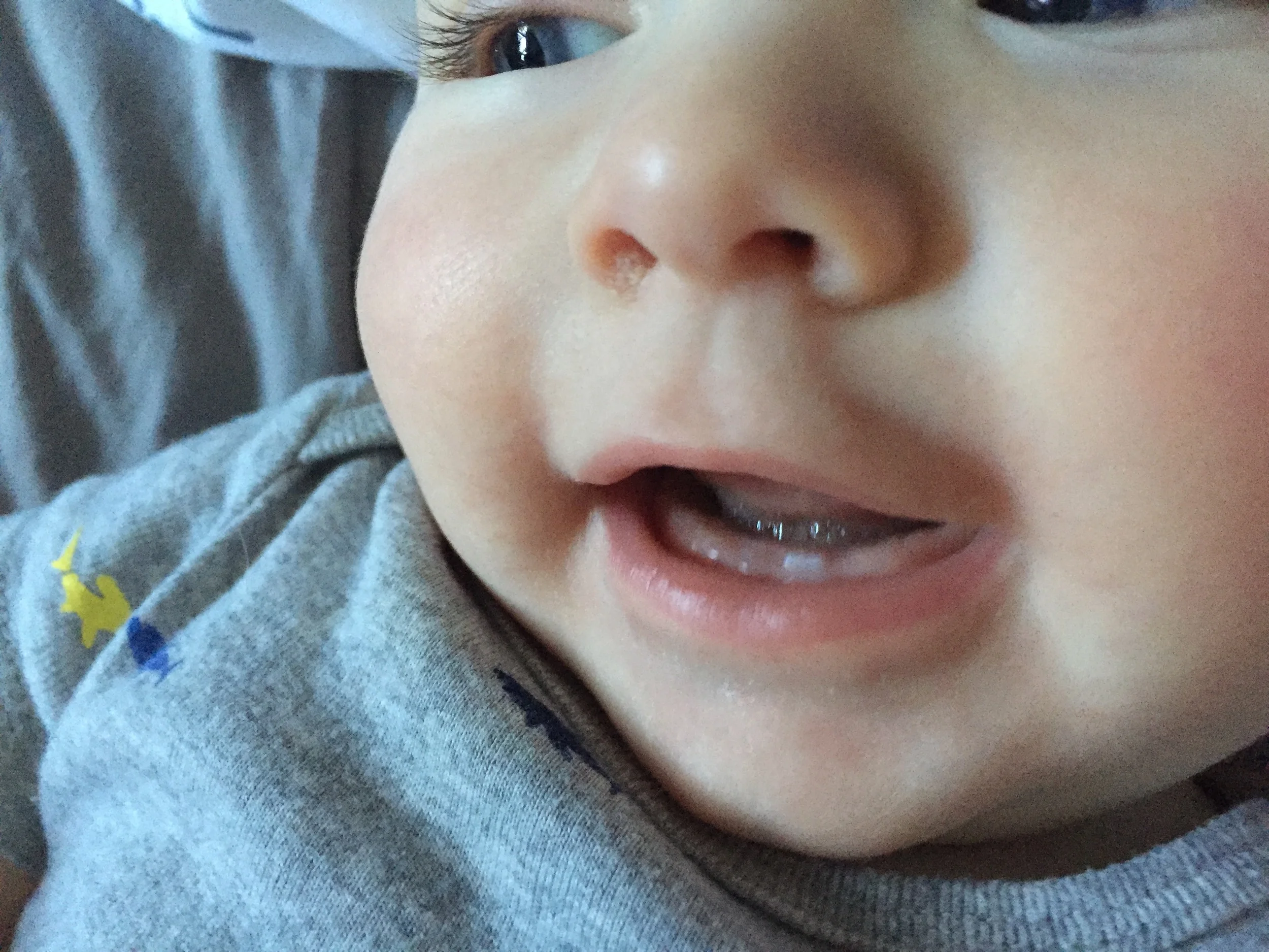 The second tooth is there..just really hard to capture in photos.