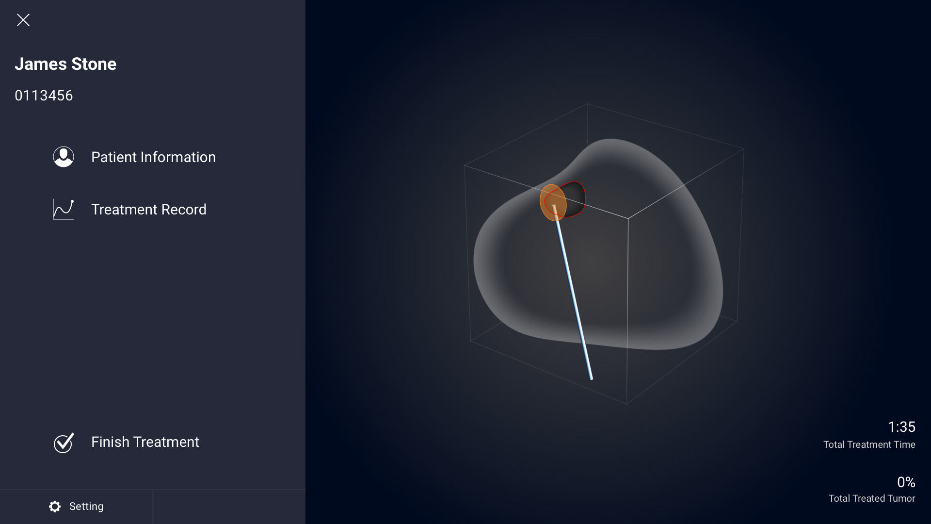 PL_menu.png