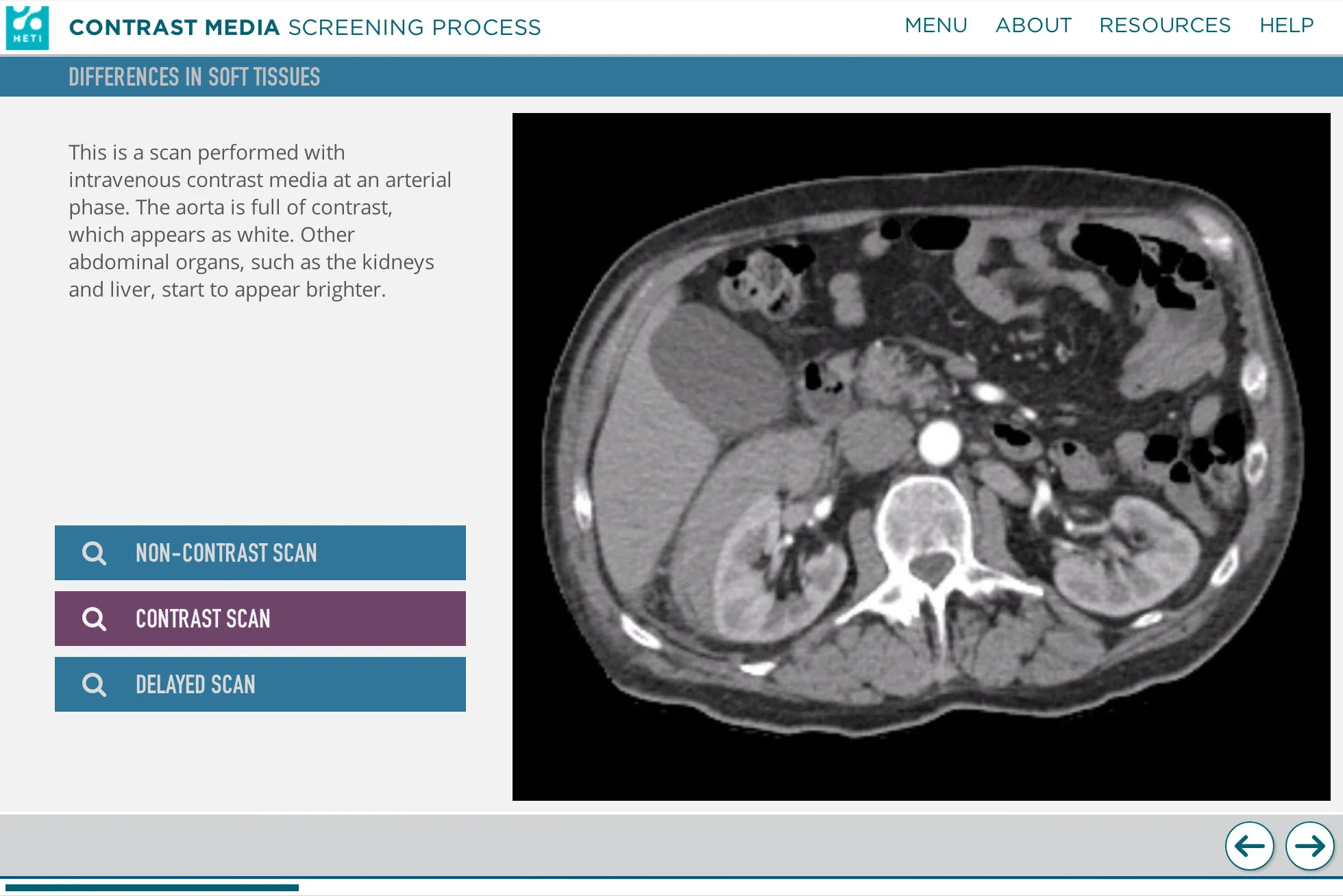HETI-Screengrabs-ConMed-02.jpg