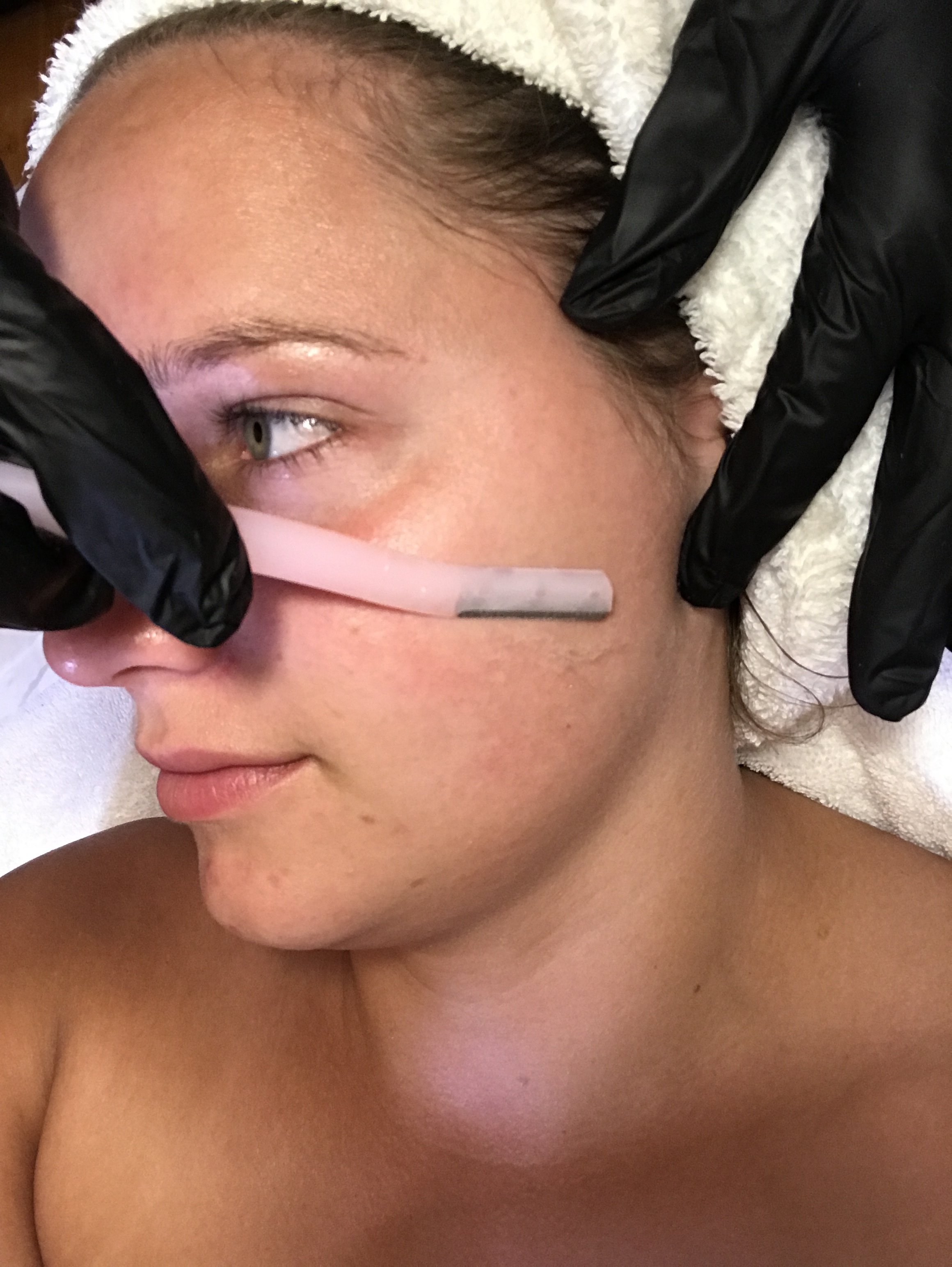 Bellingham-Dermaplaning.jpeg