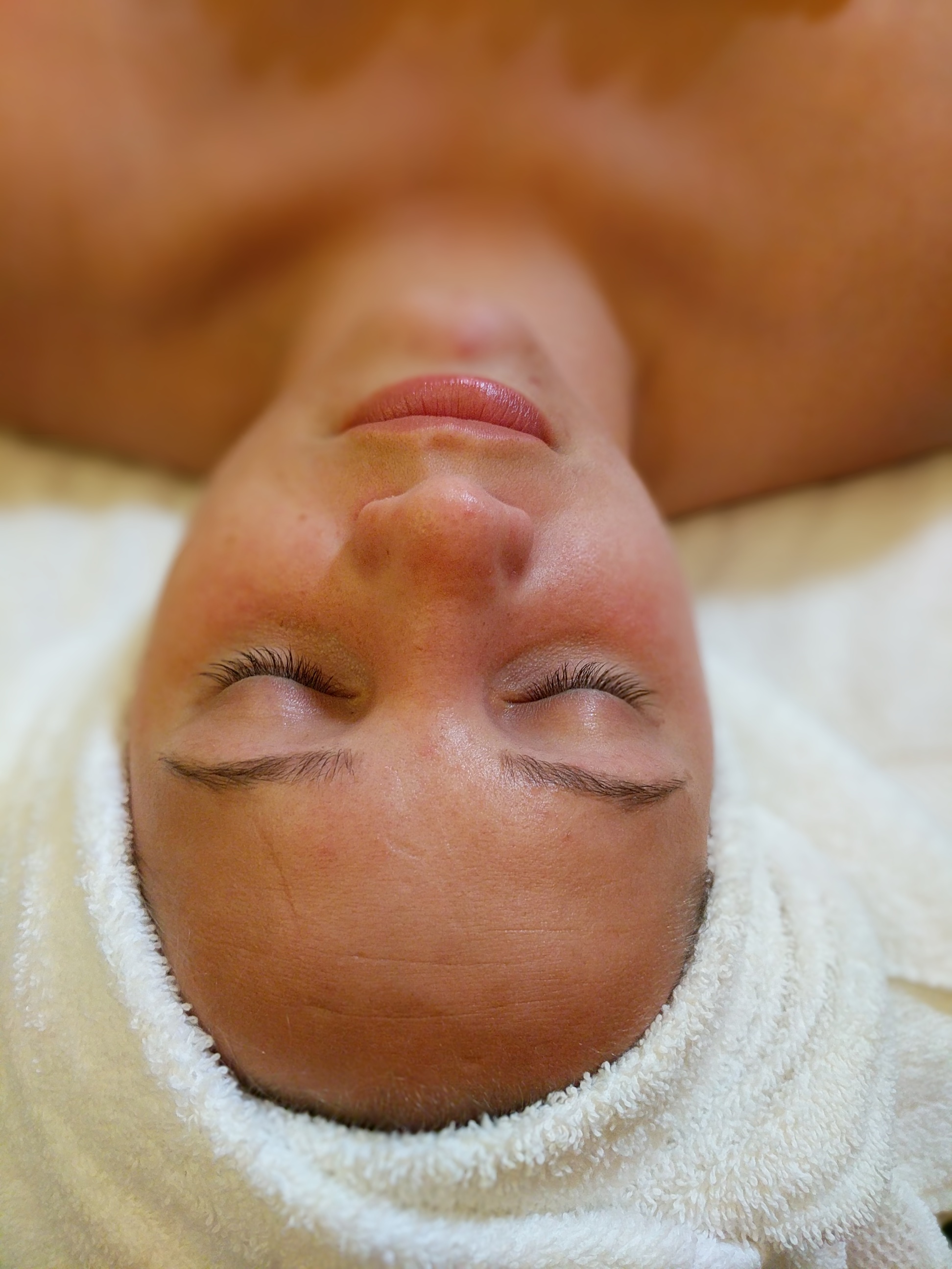 Dermaplaning Walkthrough Featuring Farmaesthetics