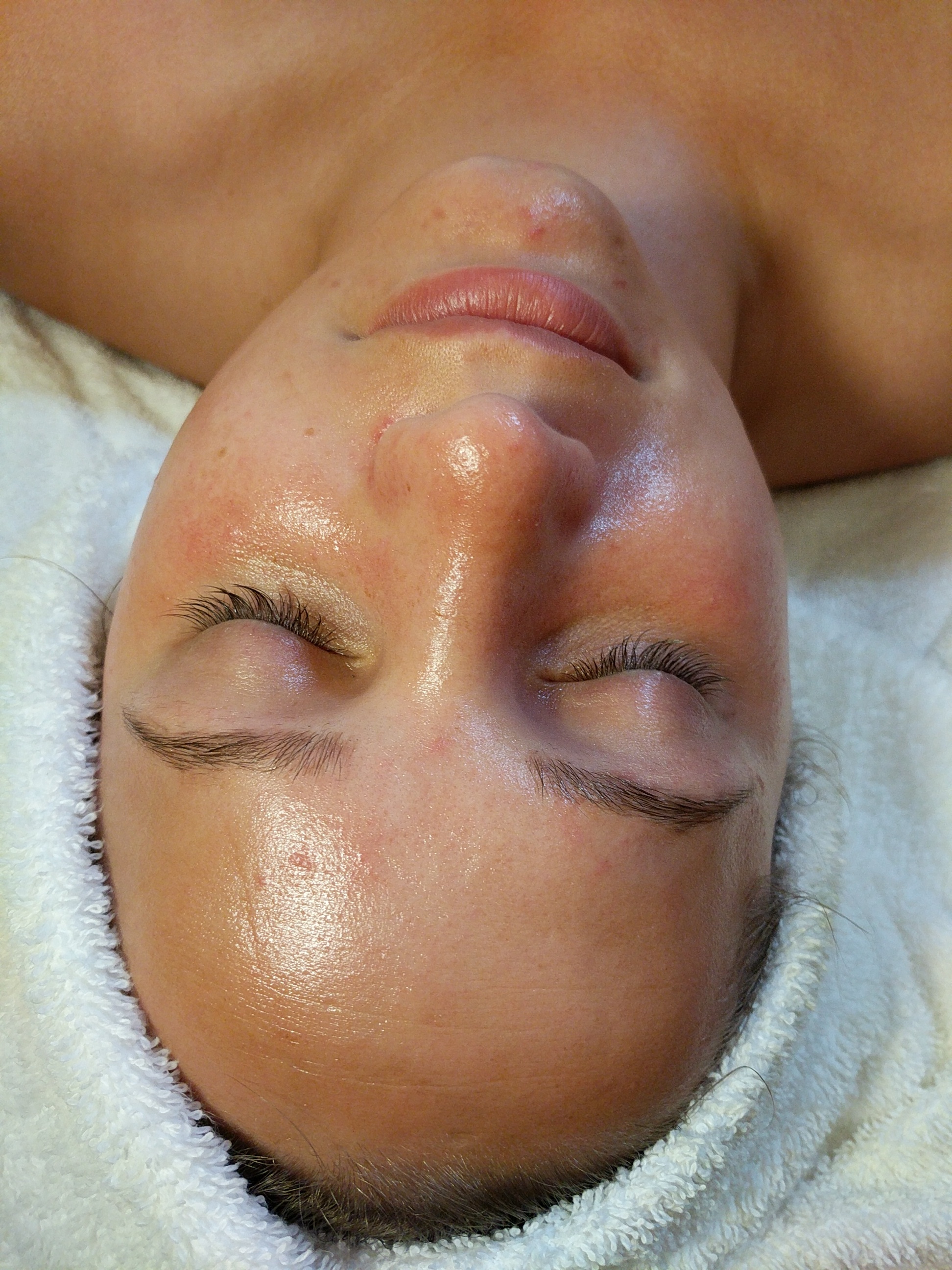 Dermaplaning Walkthrough Featuring Farmaesthetics