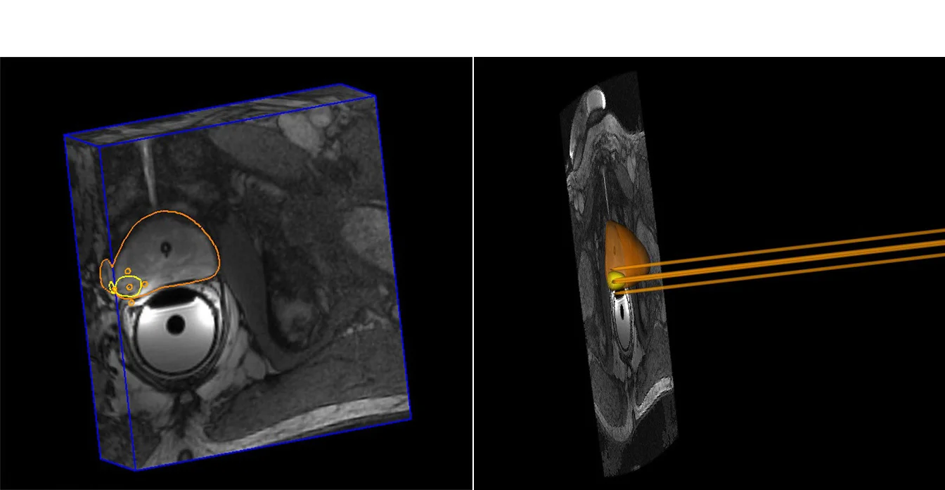 Customizable visualization software for any modality and any anatomical location