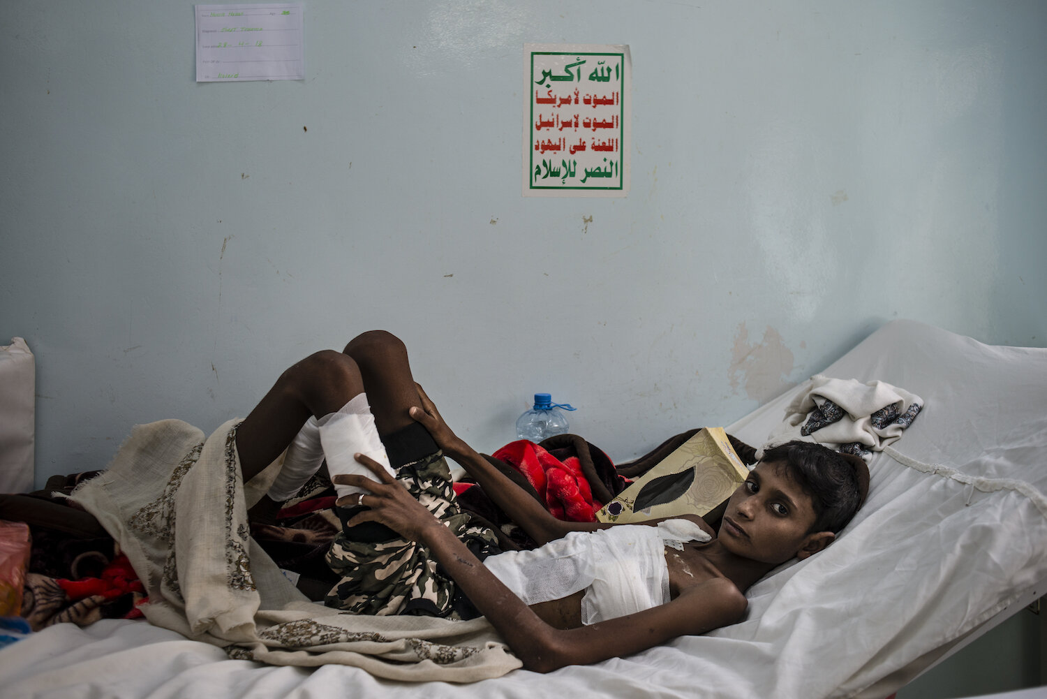  Hussein Hasan lays in bed on May 6, 2018 at Jumhuri Hospital in Hajjah, Yemen. Hussein was at the wedding when it was hit by an airstrike; he sustained severe abdominal and chest trauma and spent 10 days in intensive care. 