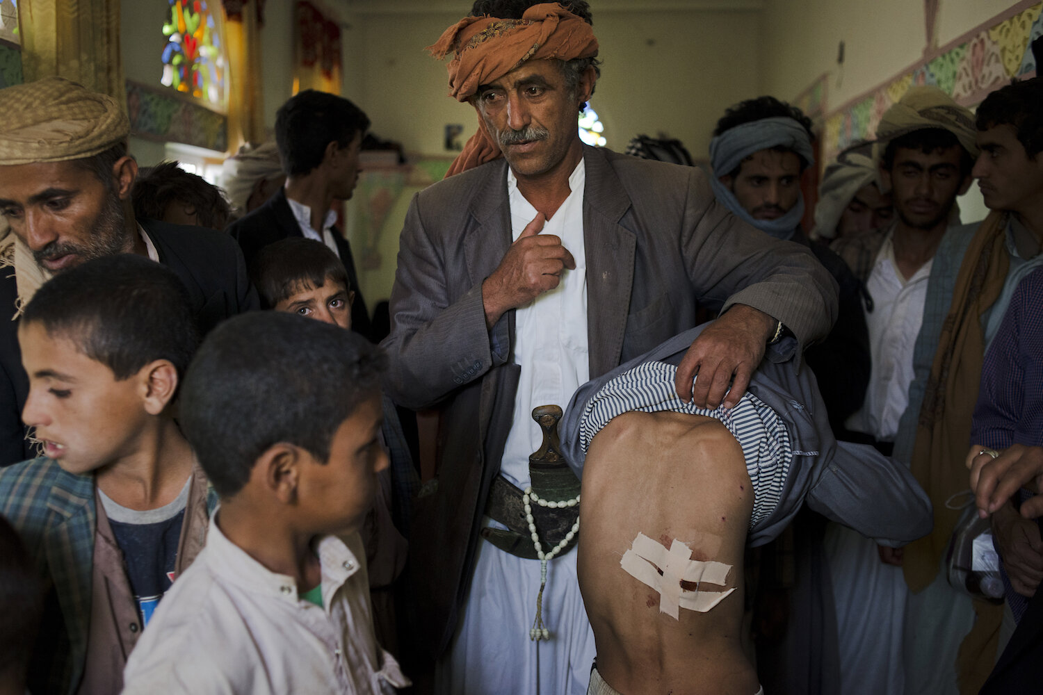  Al Joob Village, Amran Governorate, Yemen on July 7, 2015. Two airstrikes on July 6 hit a public market near homes and a mosque and farmers selling produce on the side of the road; the two combined killed over 30 civilians. 