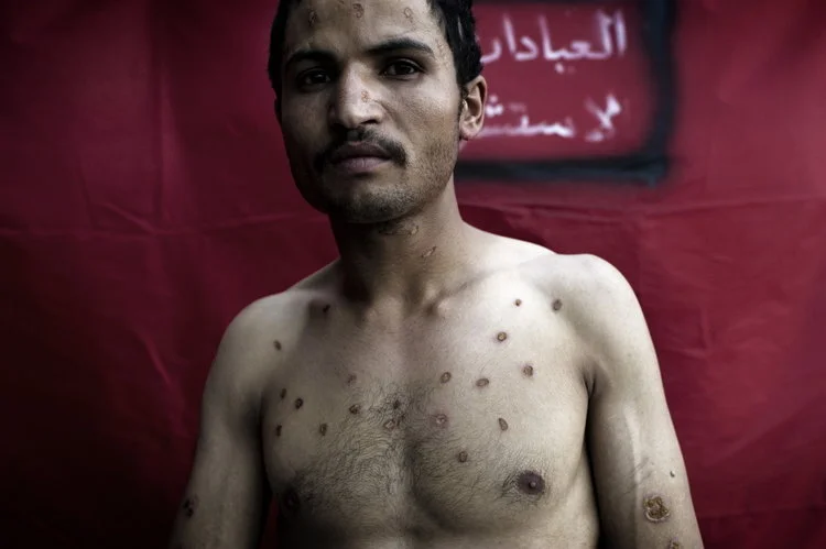 Yuri Kozyrev | Yemen's Unfinished Revolution 