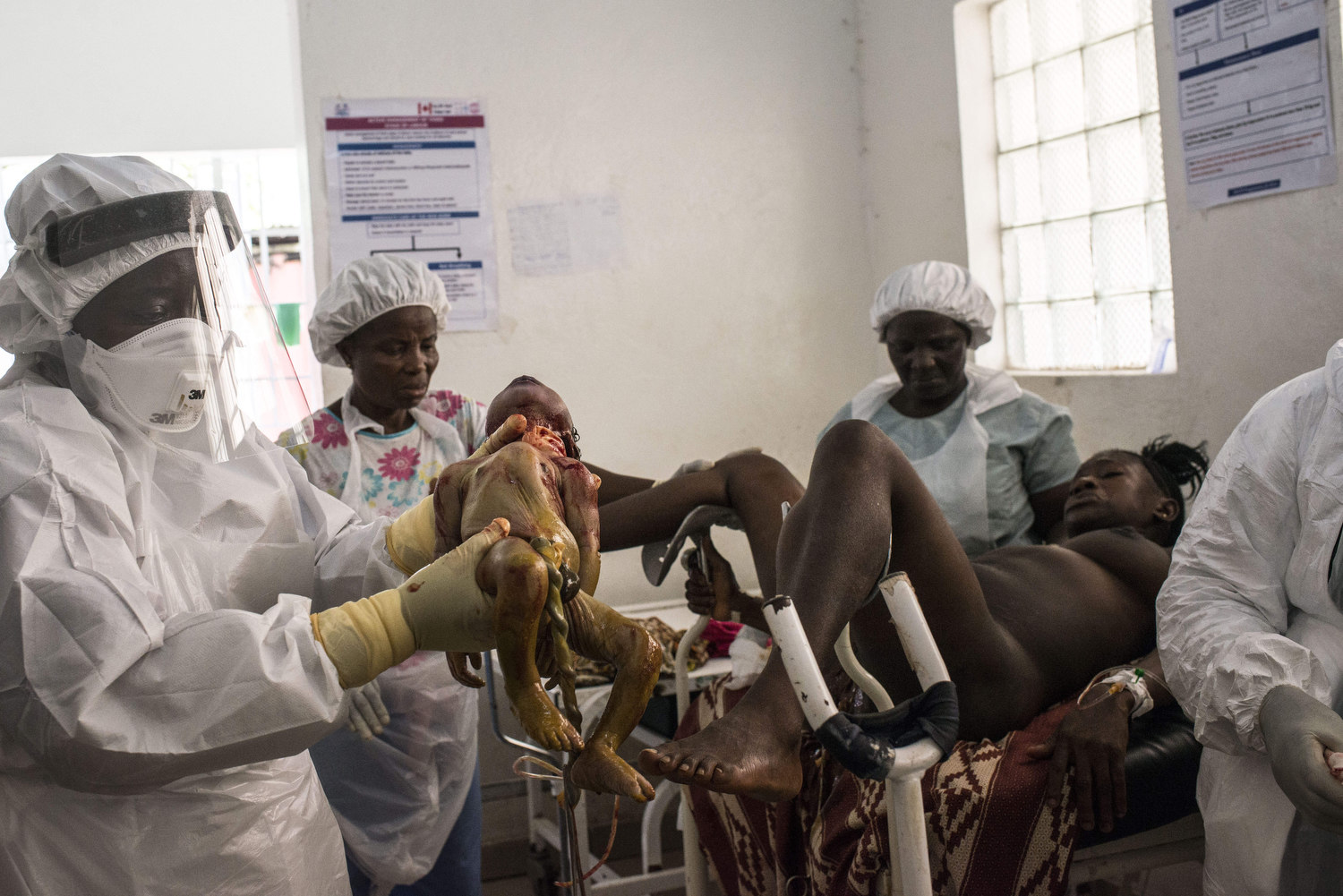  Kema James, 18 delivers in the Kenema Goverment Hospital in Kenema, Sierra Leone. Kema's baby was born with sepsis. Kema rode for a half hour on a motorbike to reach the hospital after she was referred here by her Traditional Birth Attendant. 