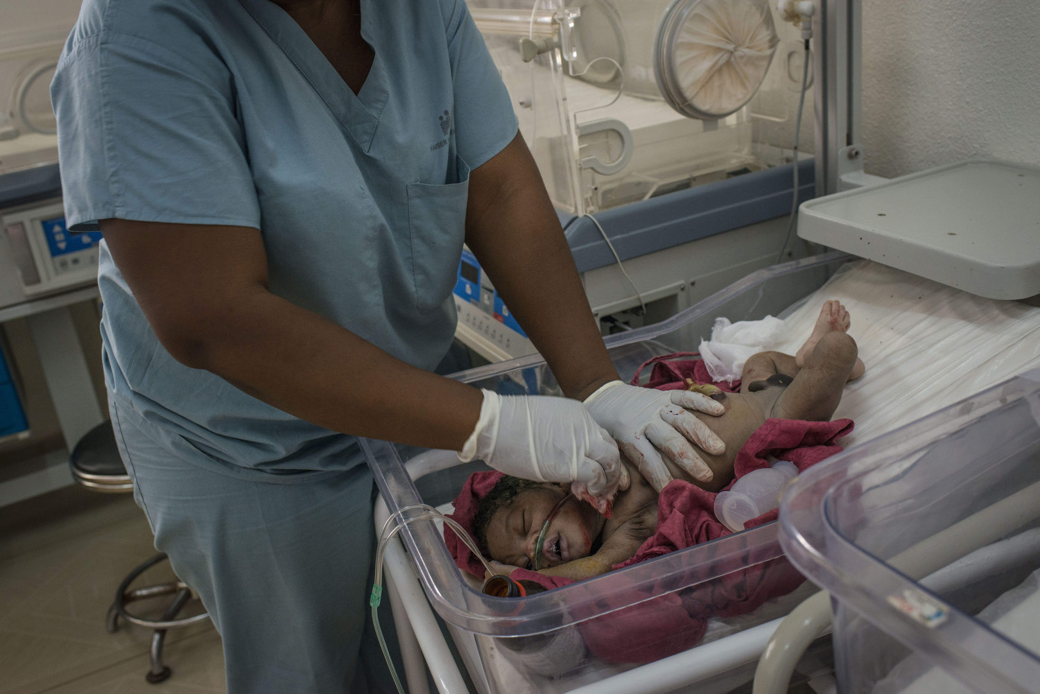  NICU nurses tend to the baby of Kema James, who was born with sepsis. 
 