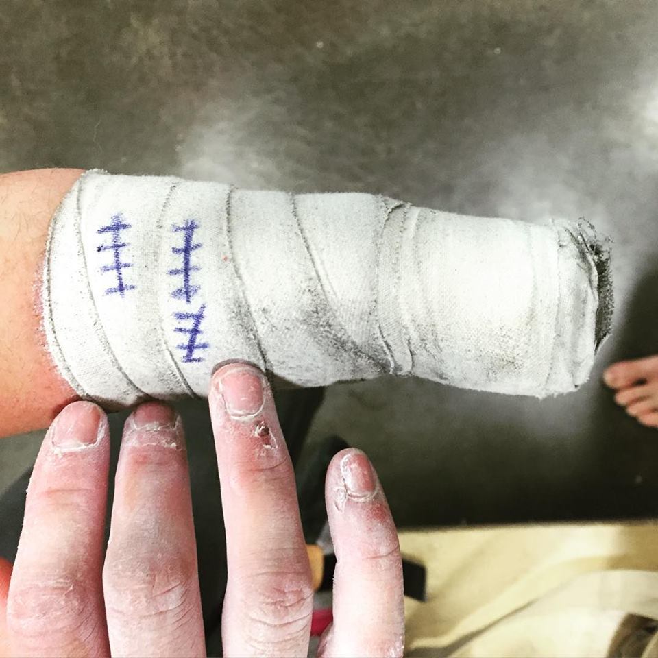 Metolius tape going strong after 15 gym laps