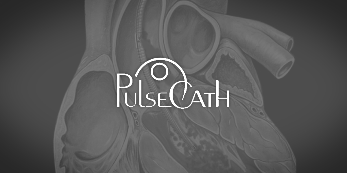 PulseCath