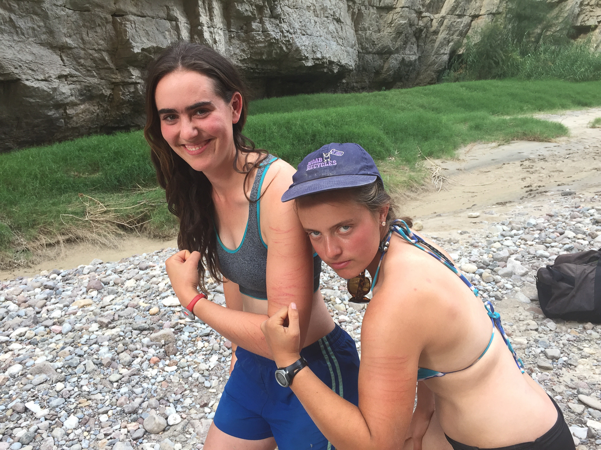 Sarah and Elizabeth show off some battle scars from day two