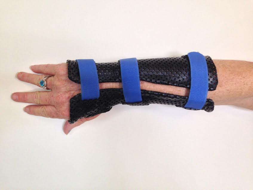 Static Forearm Based Wrist Splint1.jpg
