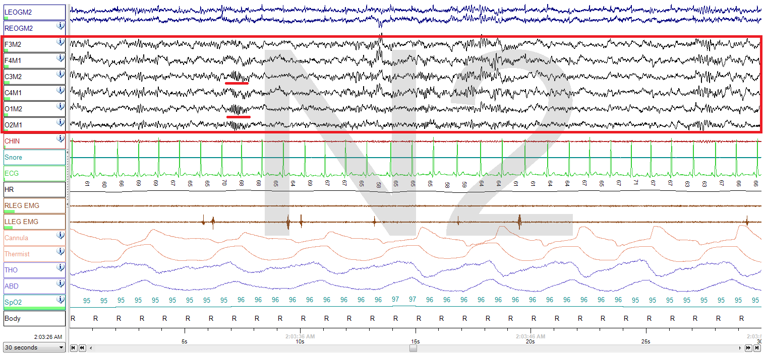 Sleep spindles, from Wikimedia Commons
