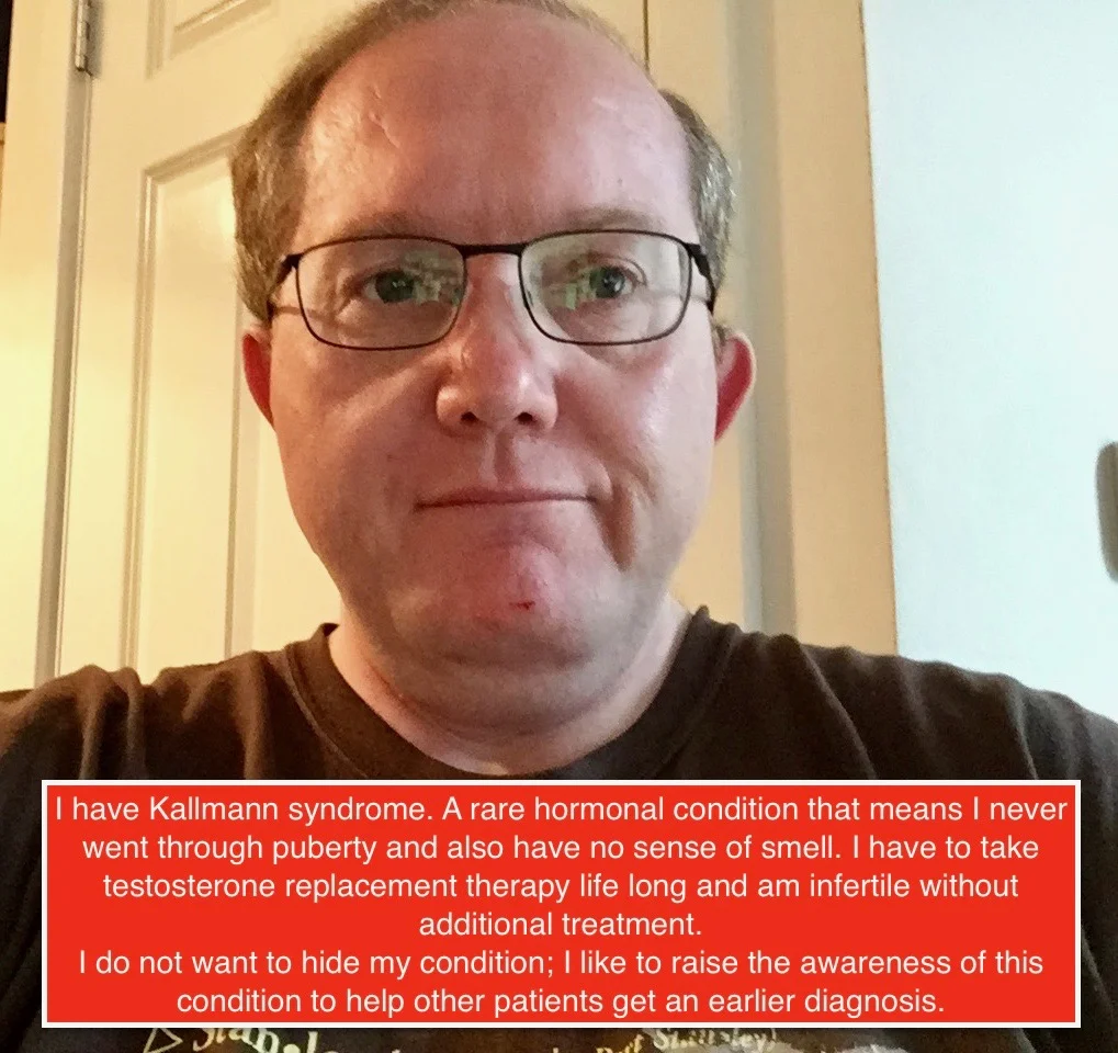 My post on Imgur
