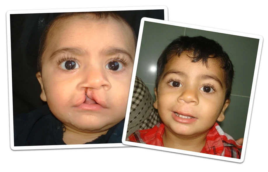 muhammad-riaz-charity-work-with-OPSA.jpg