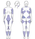Areas of the body commonly treated