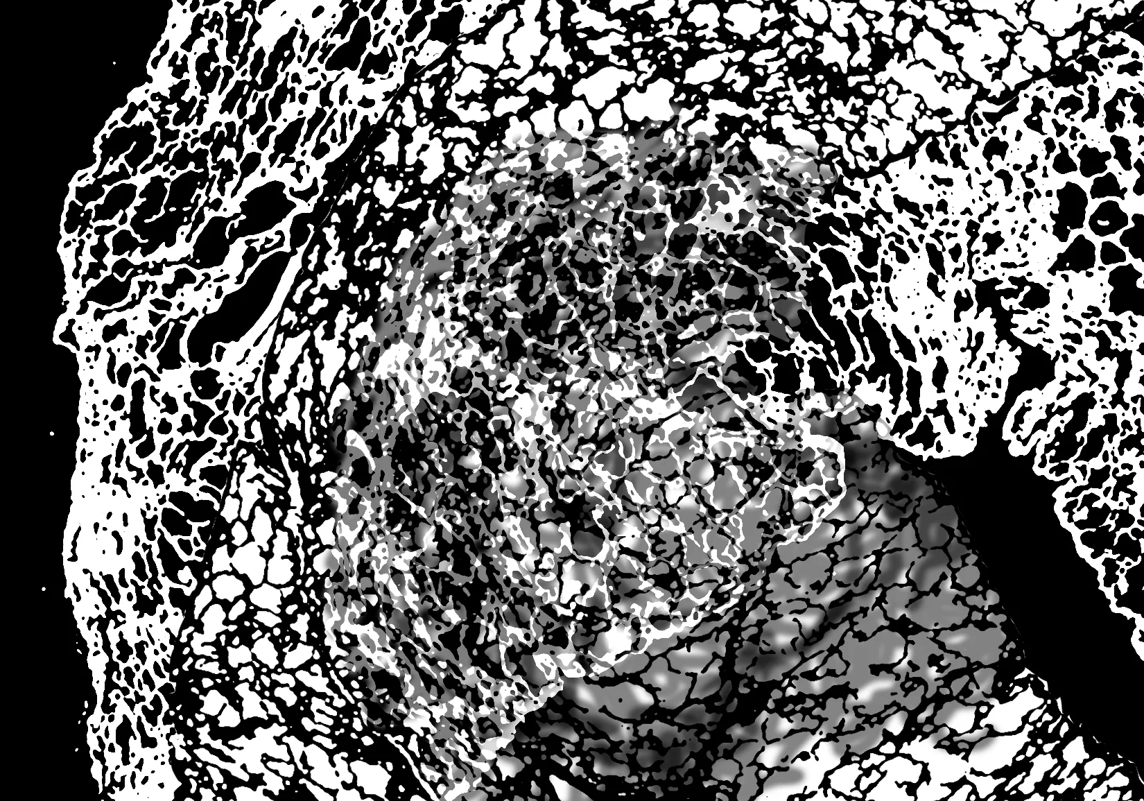 Breathe: Art in the Lab featuring Dr. Anne Sutherland, MD