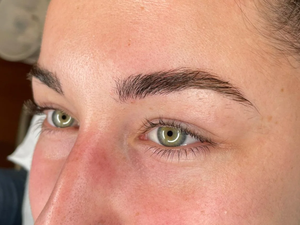 augenbrauenlifting.jpeg