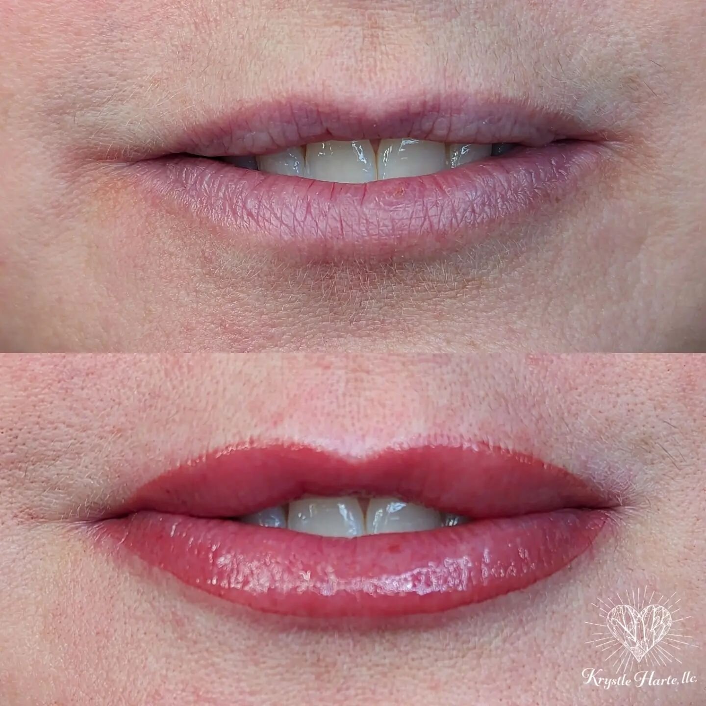 💋Lip BLUSH

✔️Lips will have a fuller appearance by adding definition to your vermilion border
✔️This procedure provides more color to your lips
✔️ Your lips will appear VERY vivid and swollen immediately following procedure
✔️lips soften 30-40% onc