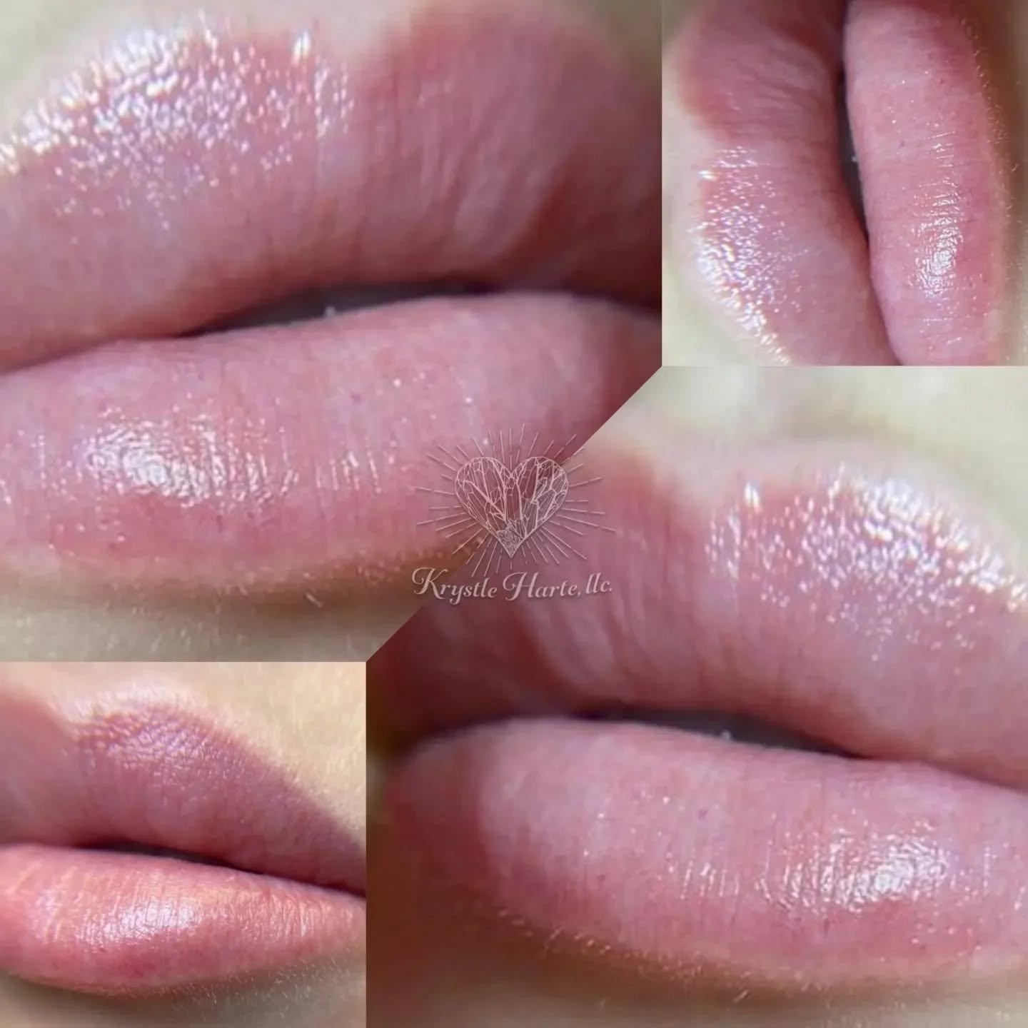 ⚠️LIPS x Healed x LIPS ⚠️

💋Lip BLUSH

✔️Lips will have a fuller appearance by adding definition to your vermilion border
✔️This procedure provides more color to your lips
✔️ Your lips will appear VERY vivid and swollen immediately following procedu