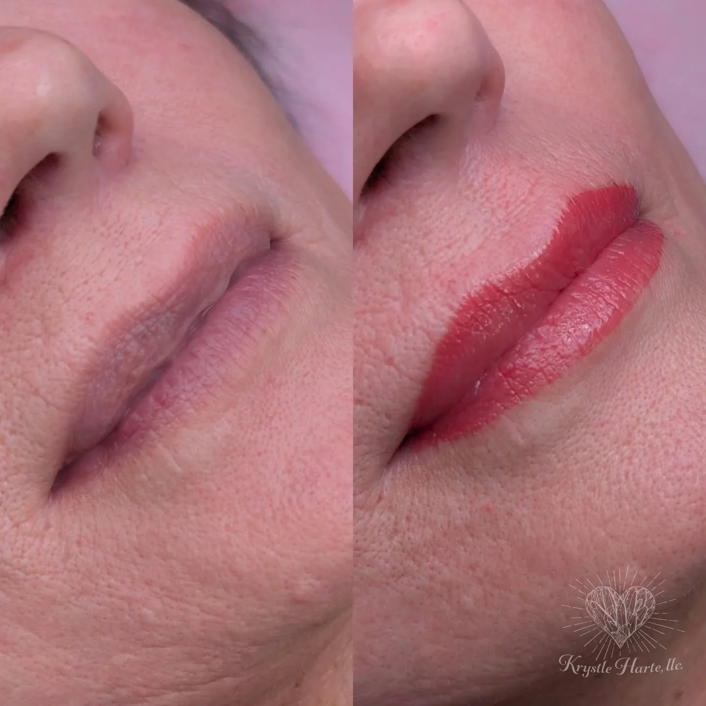 💋Lip BLUSH

✔️Lips will have a fuller appearance by adding definition to your vermilion border
✔️This procedure provides more color to your lips
✔️ Your lips will appear VERY vivid and swollen immediately following procedure
✔️lips soften 30-40% onc